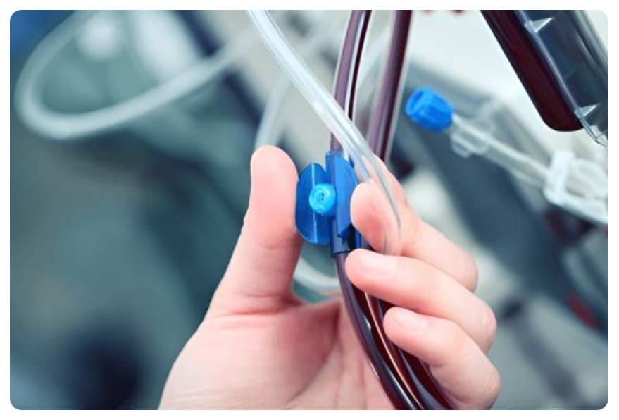 Accesos vasculares y fístulas arteriovenosas para hemodiálisis